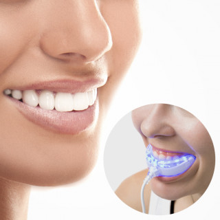 InnovaGoods Professional teeth whitener Dom